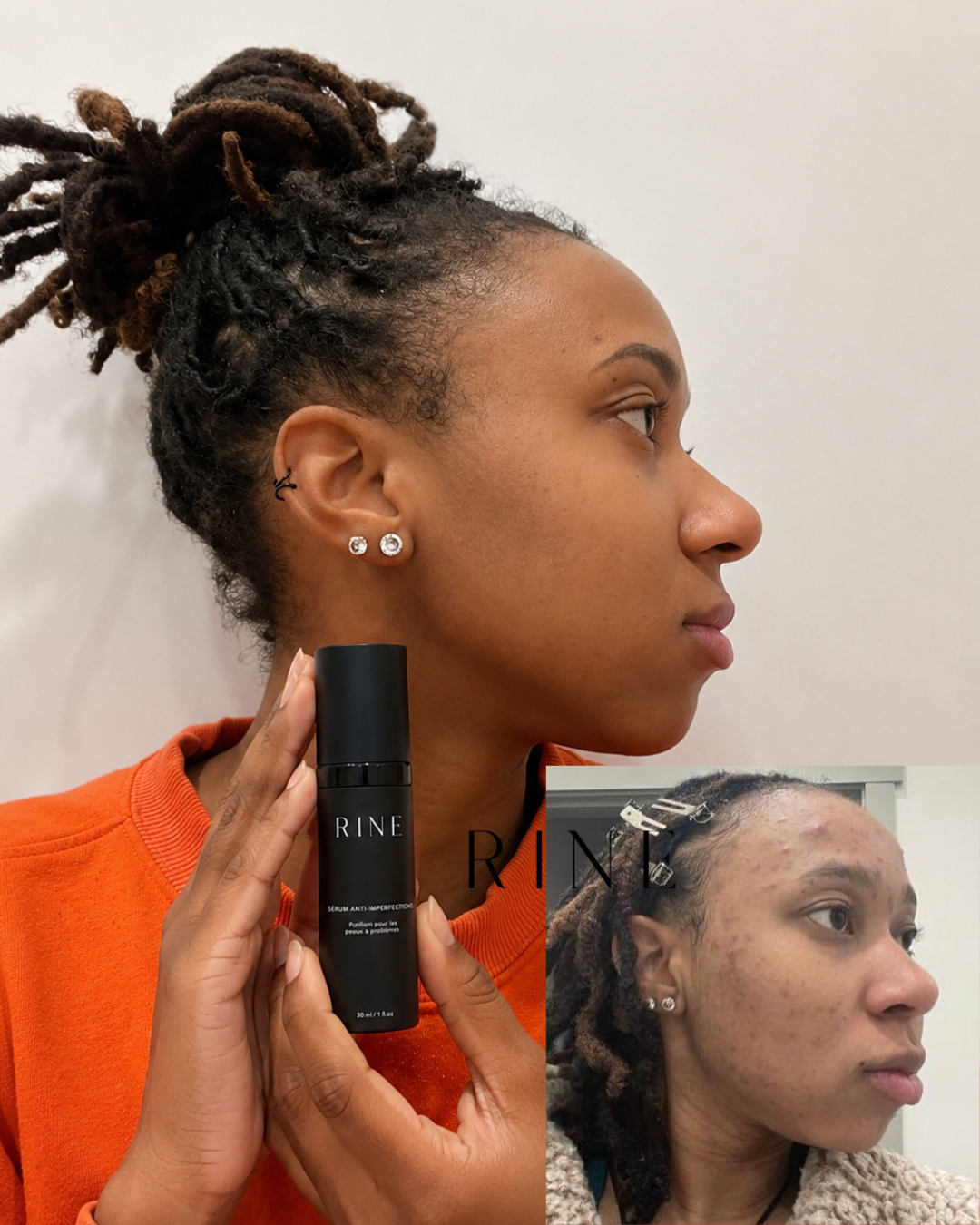 Sérum Anti-Imperfections