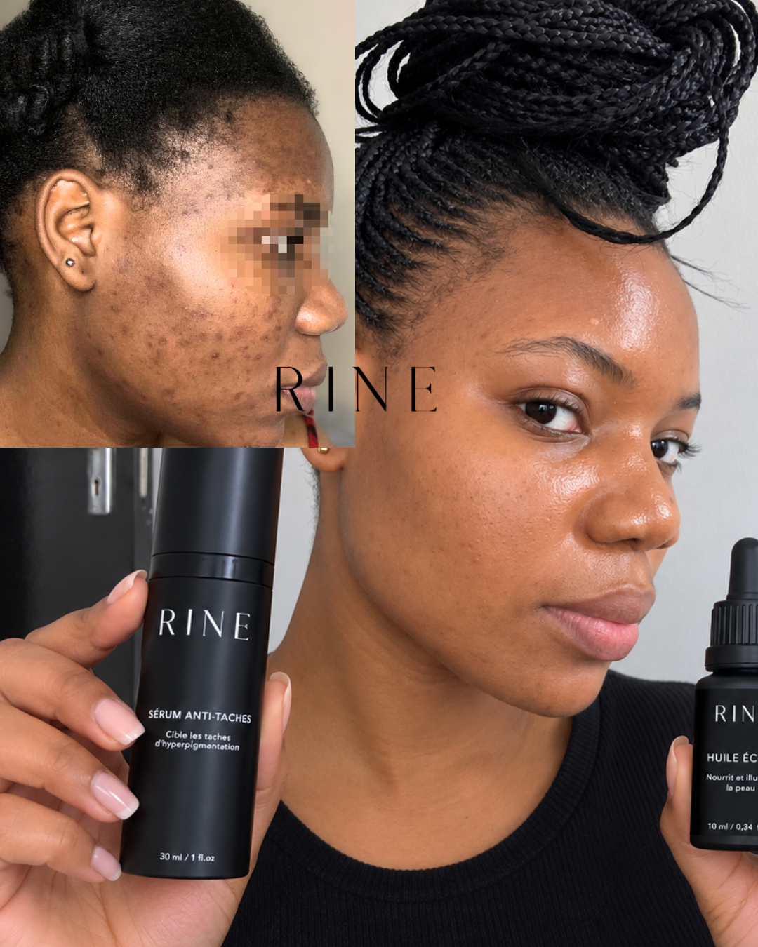 Routine Anti-Taches