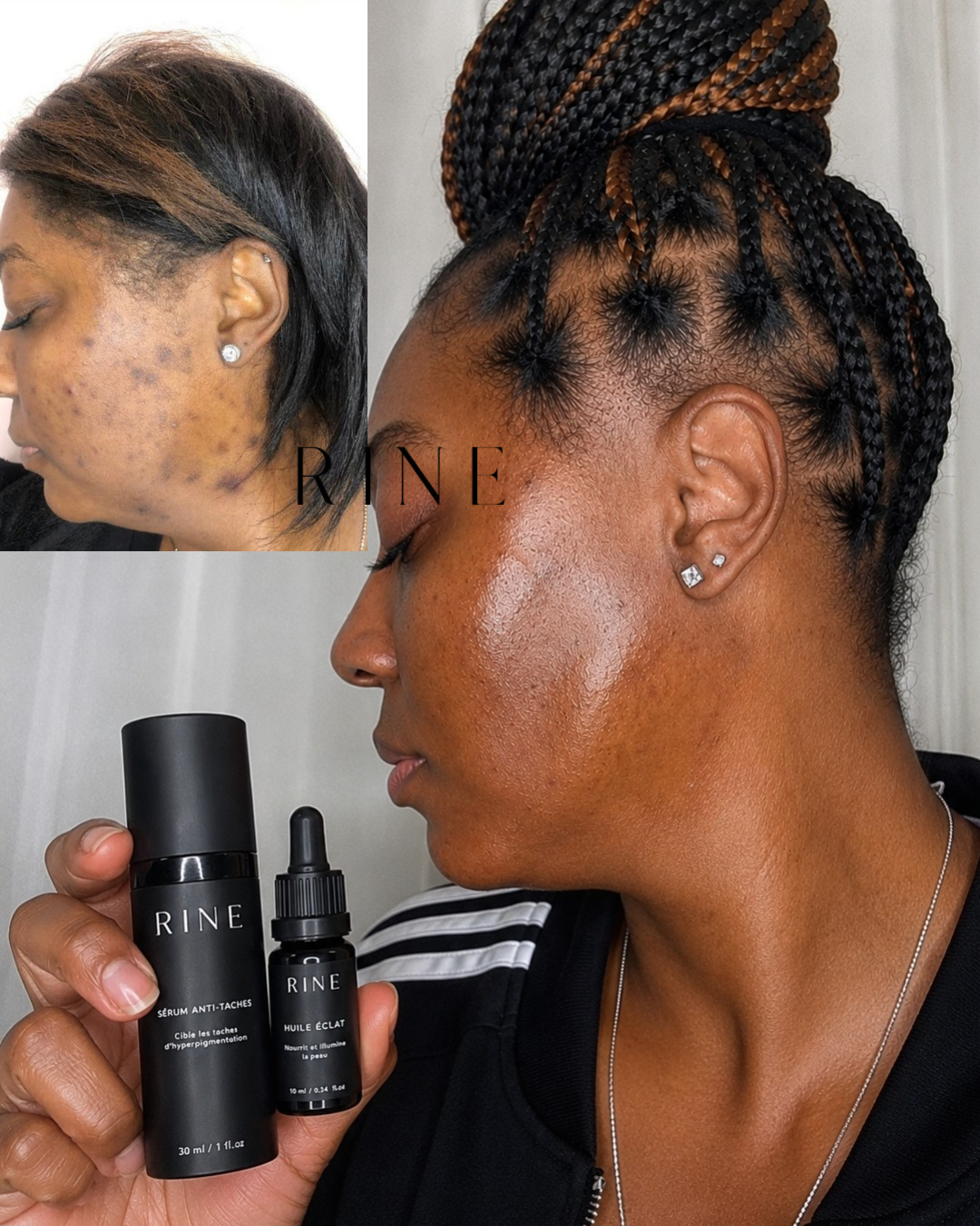 Routine Anti-Taches