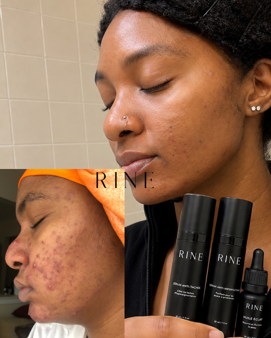 Routine Anti-Taches & Imperfections