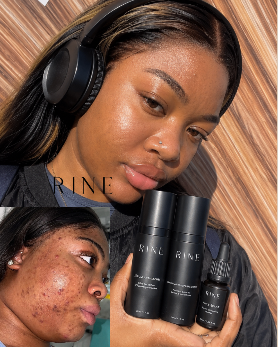 Routine Anti-Taches & Imperfections