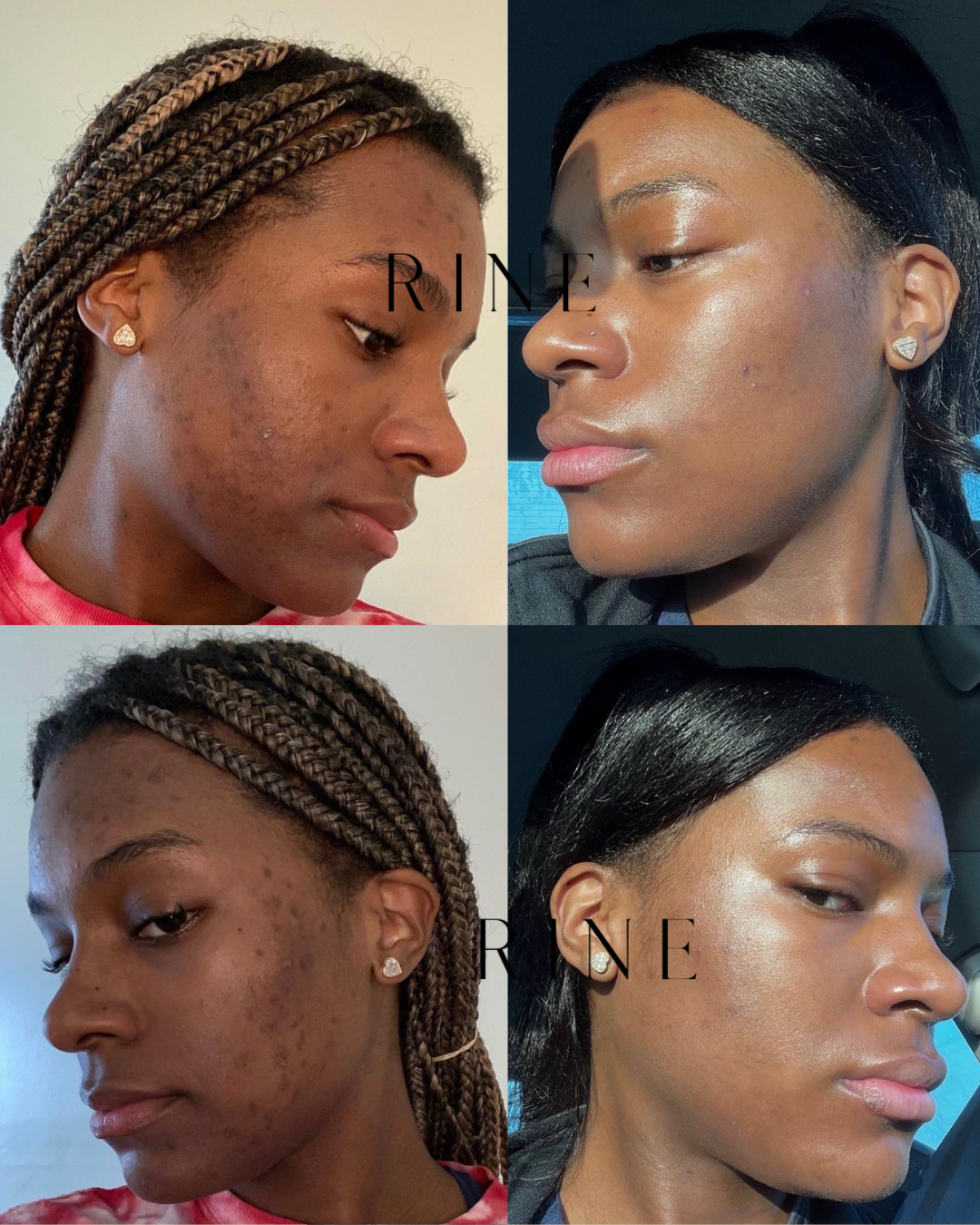 Routine Anti-Taches
