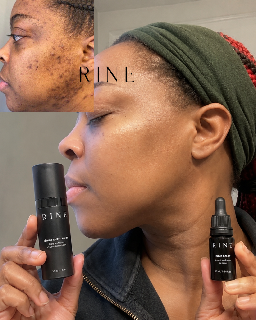 Routine Anti-Taches & Imperfections