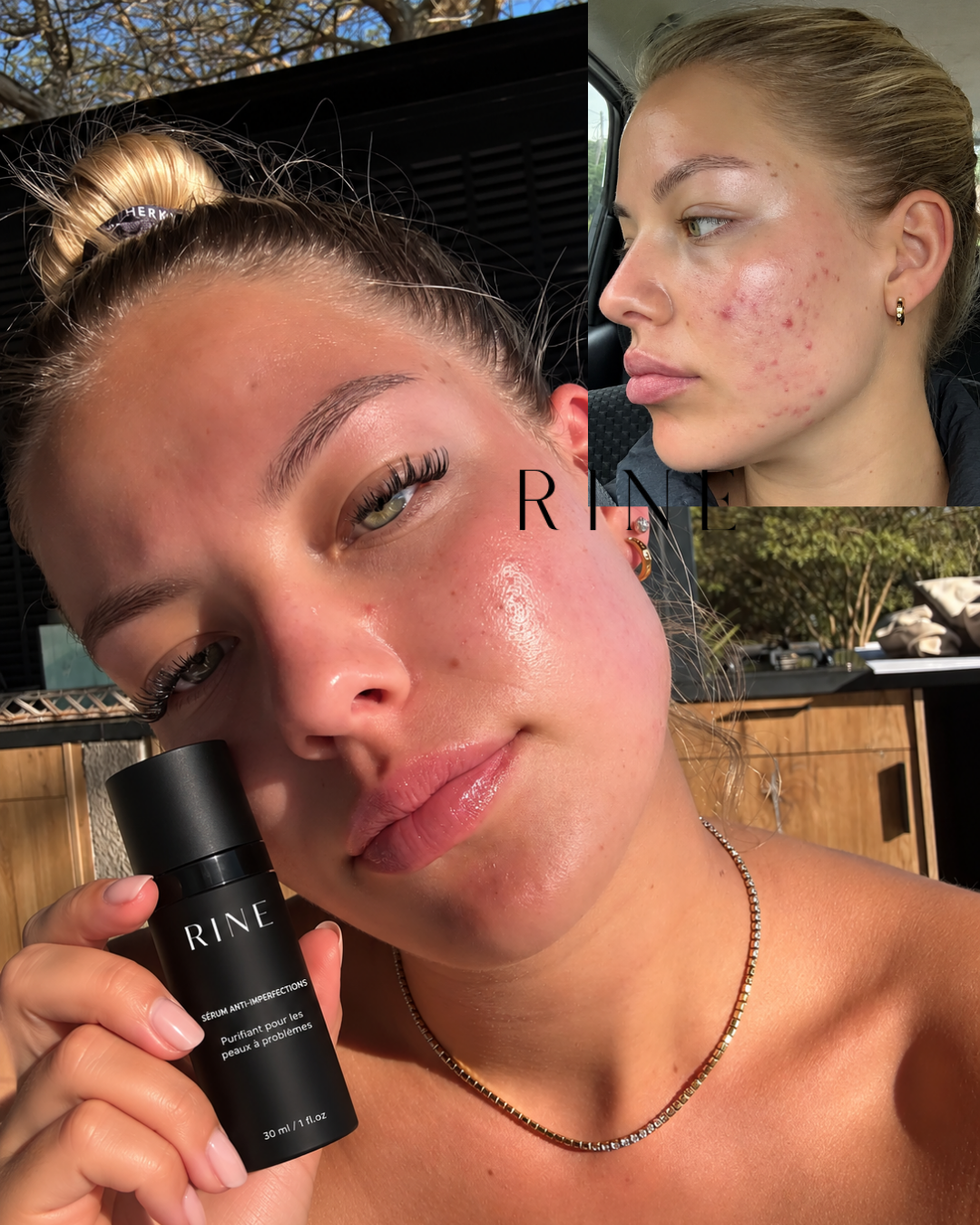 Sérum Anti-Imperfections