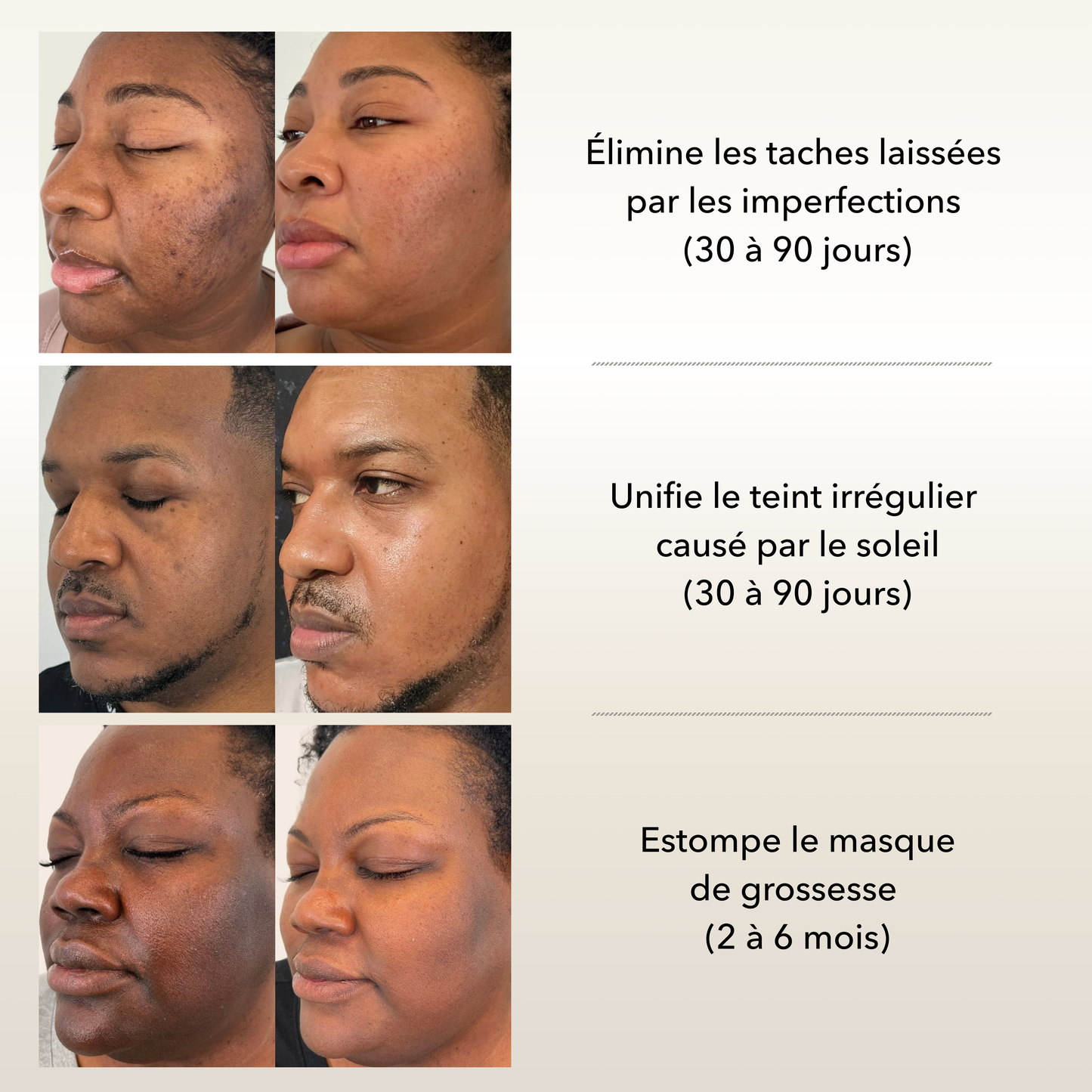 Routine Anti-Taches